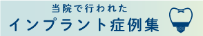 インプラント症例集｜栃内歯科医院 