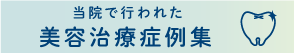 ホワイトニング｜症例集｜栃内歯科医院