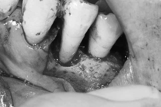 盛岡(盛岡市)の歯医者、医療法人啓仁会 栃内歯科医院の治療の流れ