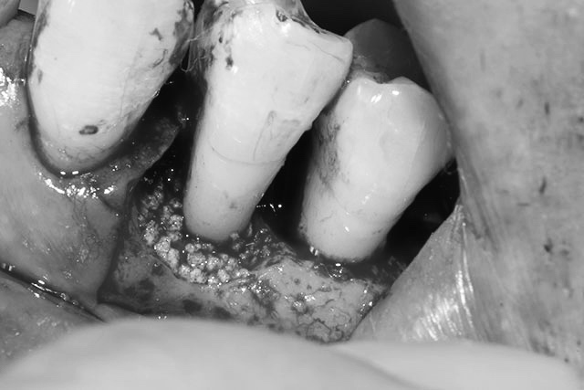 盛岡(盛岡市)の歯医者、医療法人啓仁会 栃内歯科医院の治療の流れ