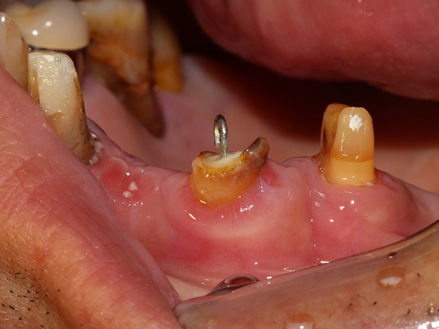 盛岡(盛岡市)の歯医者、医療法人啓仁会 栃内歯科医院の治療の流れ
