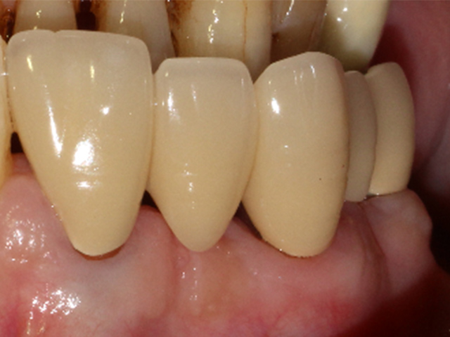 盛岡(盛岡市)の歯医者、医療法人啓仁会 栃内歯科医院の治療の流れ