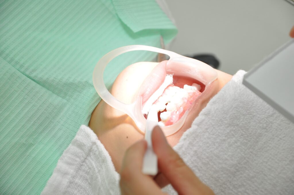 盛岡(盛岡市)の歯医者、医療法人啓仁会 栃内歯科医院のオフィスホワイトニング